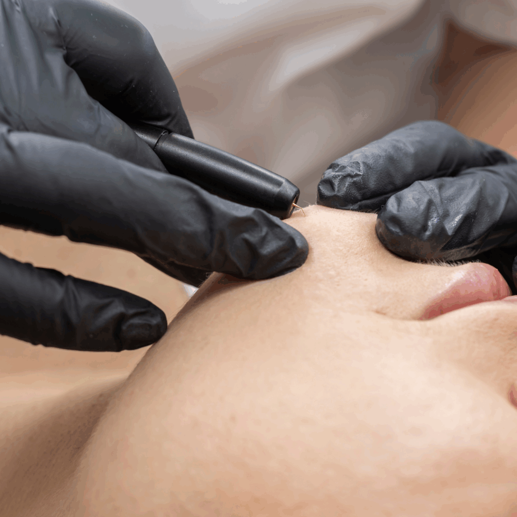 epilation-laser-esthetique-des-landes